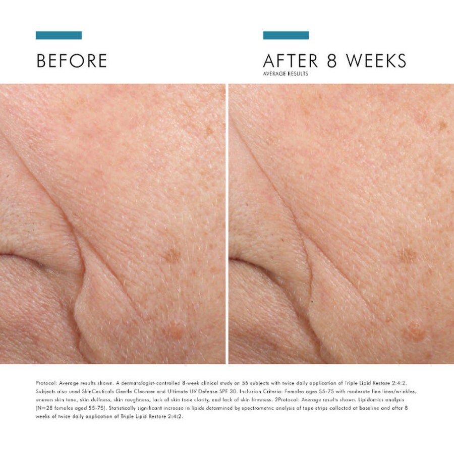 Triple Lipid Restore 242 Anti Ageing Moisturiser - Lift Aesthetics Sydney