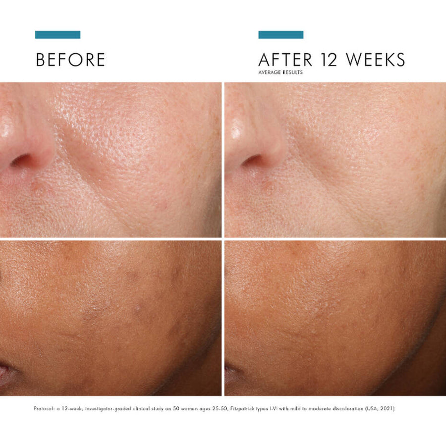 Phloretin CF Vitamin C Serum - Lift Aesthetics Sydney